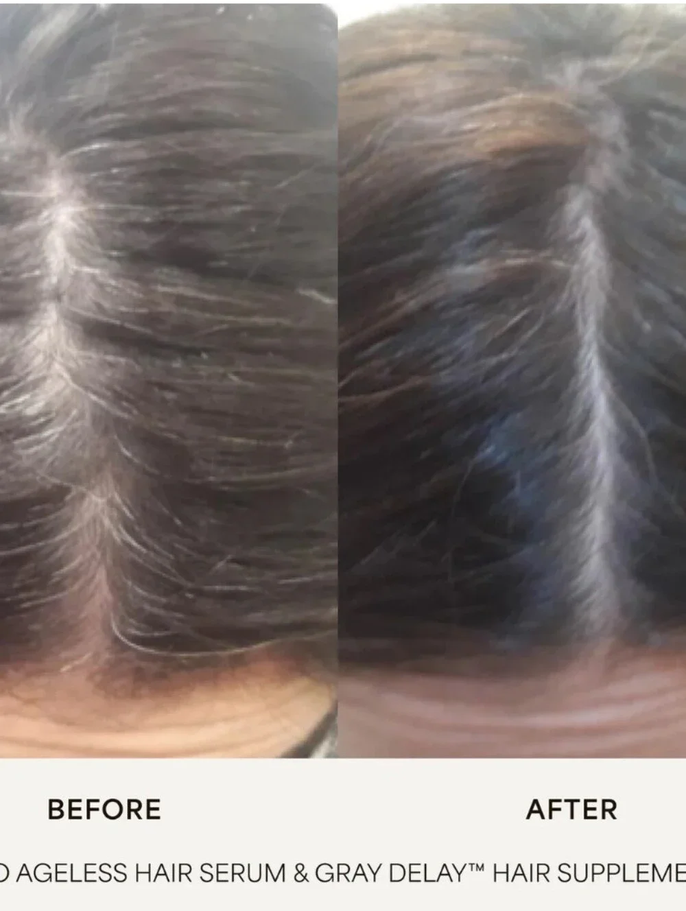 Vegamour gro ageless